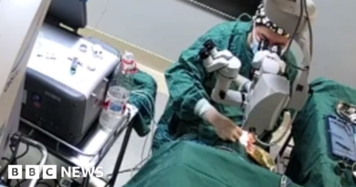 China: Outrage over doctor punching patient during surgery