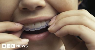 Smile Direct Club dentistry aligners firm shuts down