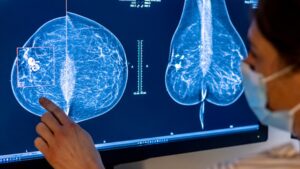 Biotech and pharma companies are betting on a promising class of cancer drugs to drive growth