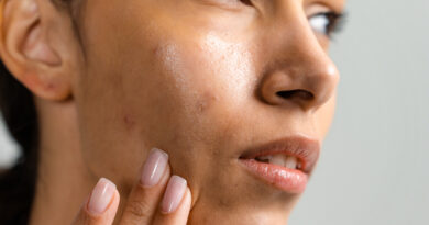 How To Remove Acne Scars Naturally? We Asked the Experts