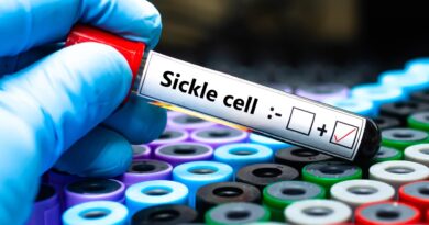 New sickle cell gene therapies are a breakthrough, but solving how to pay their high prices is a struggle