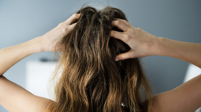 The 9 Best Home Remedies for an Itchy Scalp