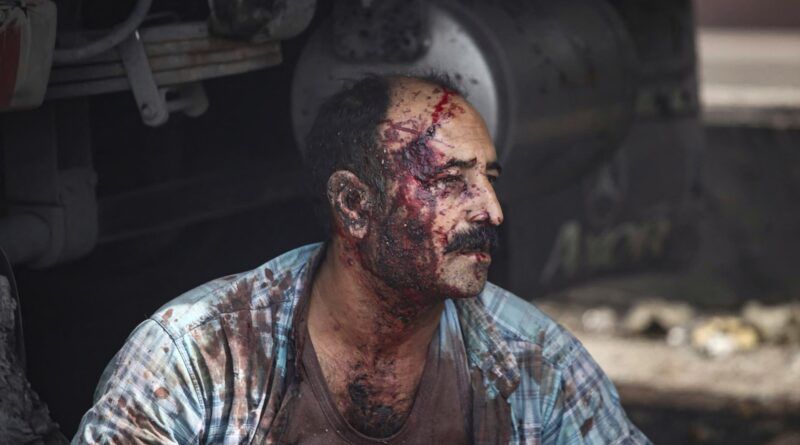 Deadly explosion shakes Iran, hundreds hospitalised after port fire