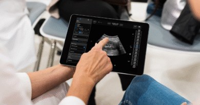 Samsung may invest in $100M round for medical imaging startup Exo | TechCrunch