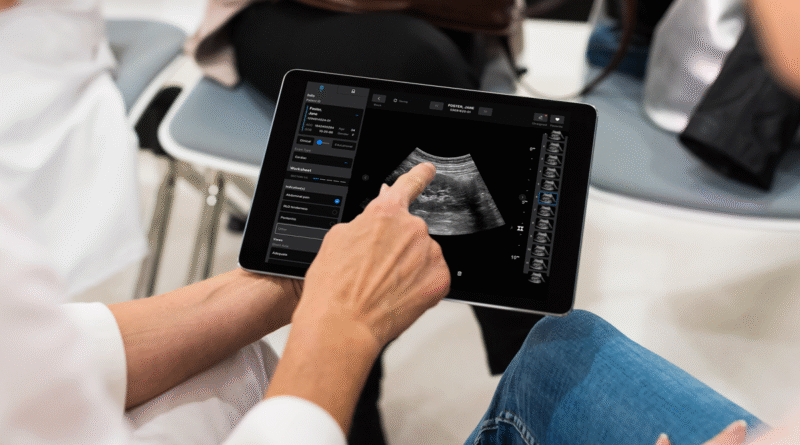 Samsung may invest in $100M round for medical imaging startup Exo | TechCrunch