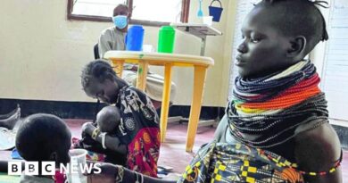 Malnutrition in Kenya's Kakuma refugee camp after US aid cuts