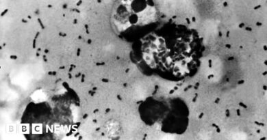 Arizona resident dies from pneumonic plague, health officials say