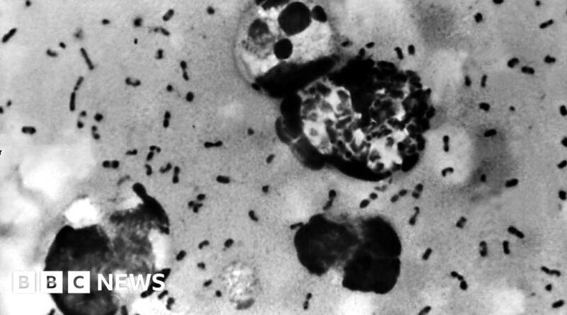 Arizona resident dies from pneumonic plague, health officials say