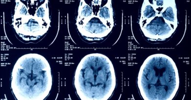 a selection of X-ray scans of a human head