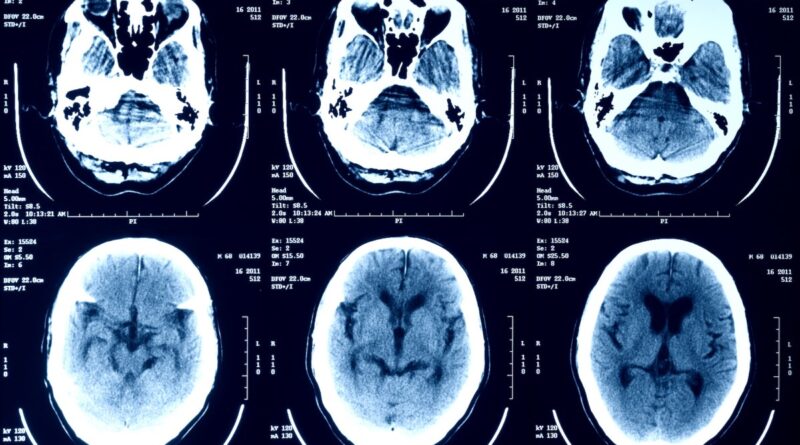a selection of X-ray scans of a human head