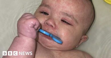 How Canada became the centre of a measles outbreak in North America
