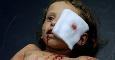 I was training to heal eyes in Gaza. Then everything went dark