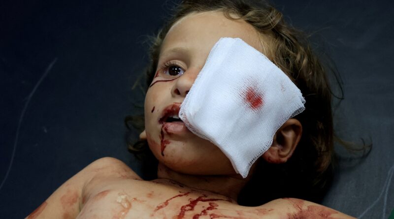 I was training to heal eyes in Gaza. Then everything went dark