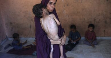 NGO says starving Gaza children too weak to cry