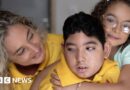 Ten years after the Zika outbreak: What happened to the babies born with microcephaly?