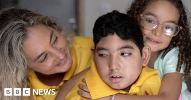 Ten years after the Zika outbreak: What happened to the babies born with microcephaly?