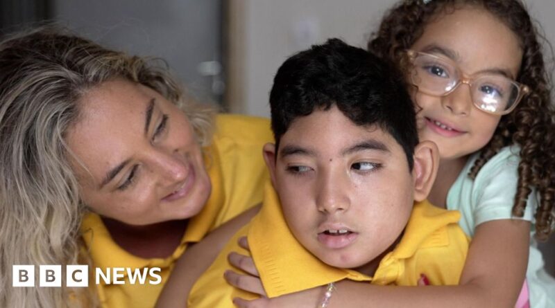 Ten years after the Zika outbreak: What happened to the babies born with microcephaly?