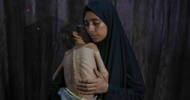 Where does Trump stand on Israel’s starvation of Palestinians?
