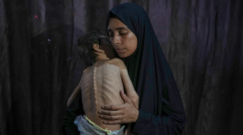 Where does Trump stand on Israel’s starvation of Palestinians?
