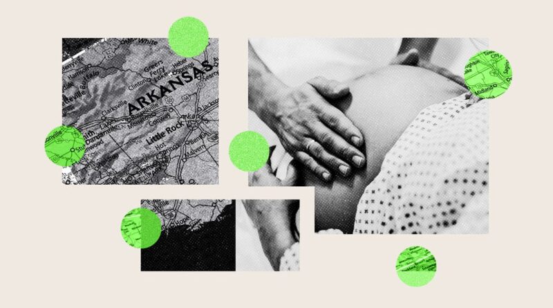 C-section rates vary widely by hospital, but transparency is rare. A map shows the states that withhold data.