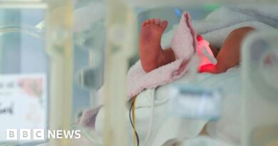 Two Austrian women switched at birth meet 35 years later