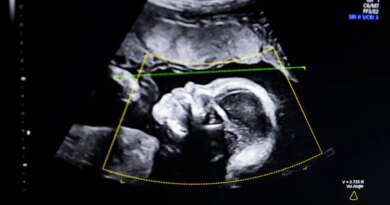 BioticsAI, which won Disrupt's Battlefield competition in 2023, gains FDA approval for its AI-powered fetal ultrasound product  | TechCrunch
