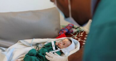 Hunger is looming over Yemen, urgent action is needed