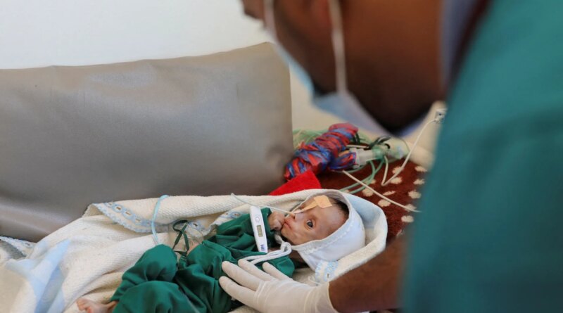 Hunger is looming over Yemen, urgent action is needed