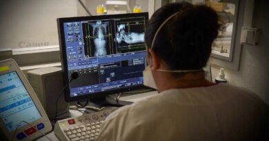 Doctor observing the images of a scanner in the emergency room of a university hospital.