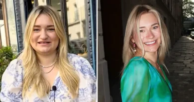 After a break-up, I paid $20K for a glow-up at 28. People on social media accuse me of using AI because I look so different.