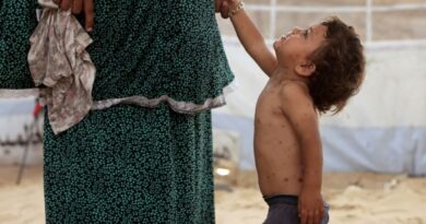 'All these rashes': chickenpox surges in Gaza camps