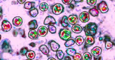 Amid Cyclosporiasis Outbreak, Measles Cases Are Nearing Last Year's Total