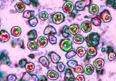 Amid Cyclosporiasis Outbreak, Measles Cases Are Nearing Last Year's Total