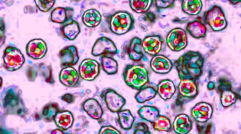 Amid Cyclosporiasis Outbreak, Measles Cases Are Nearing Last Year's Total