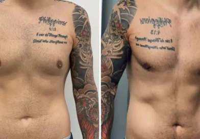 Men get cosmetic surgery, too. I spent $14,000 on plastic surgery, and I don't regret it.
