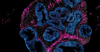 2DOrganoidSlice_greynuclei_pinksmoothmuslce_blueepithelium_