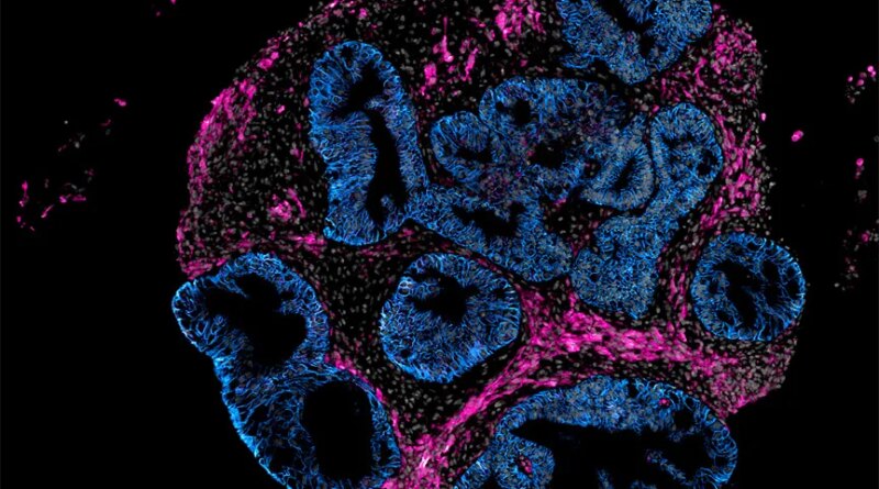 2DOrganoidSlice_greynuclei_pinksmoothmuslce_blueepithelium_